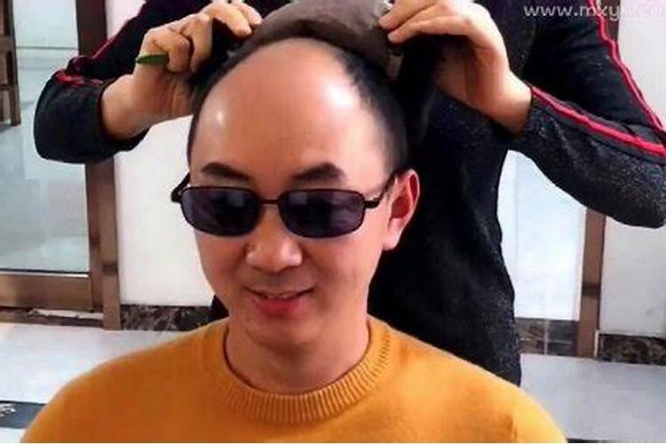 梦到自己秃顶是什么预兆女生解梦？