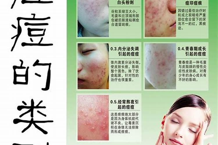 是什么生肖会长痘的？