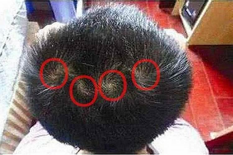 童子命头上有两个旋吗？