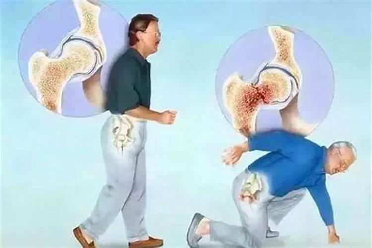 梦见老人摔倒出血是怎么回事？