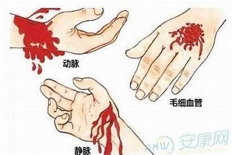 梦见手受伤有几道口子出血？