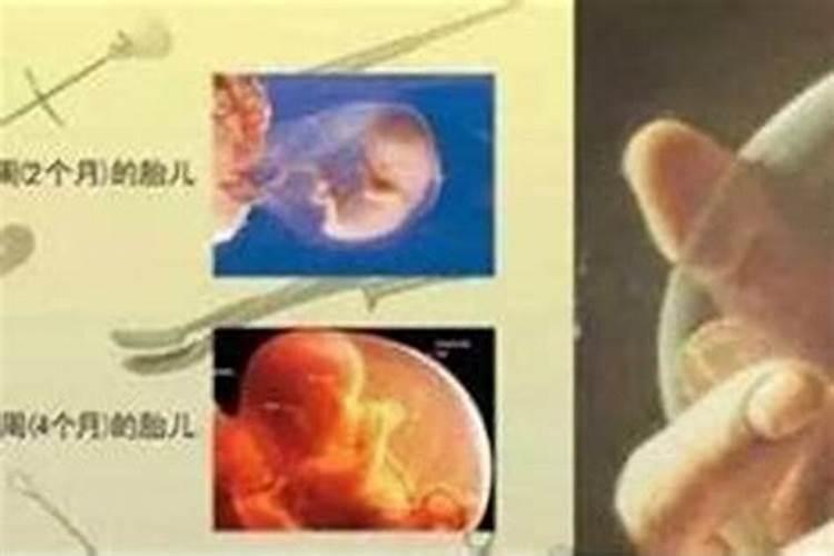 堕胎婴灵对男的有影响吗？