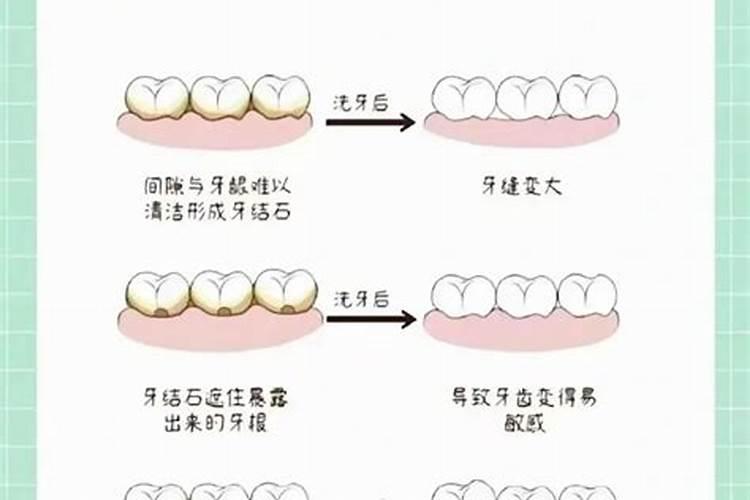 小年洗牙好不好？