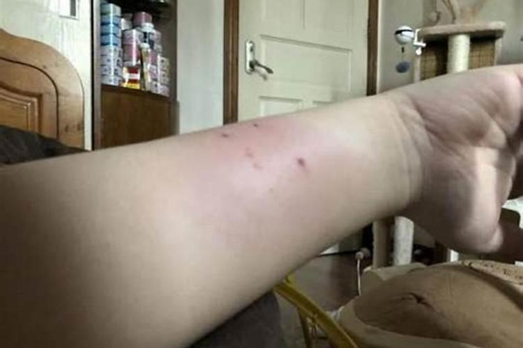 梦见被猫追咬怎么回事？