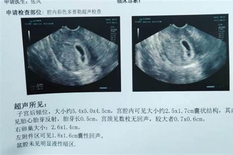 孕囊是扔了还是埋了？