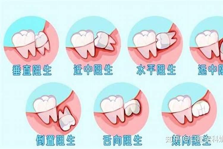 长智齿预示着什么运势？