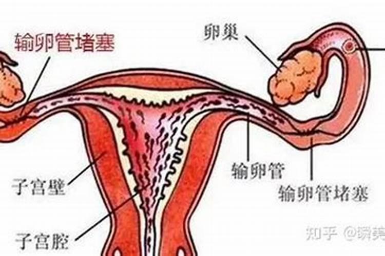 女性流产三次后果
