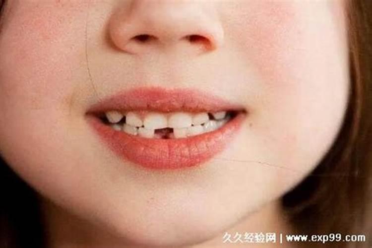 梦见掉牙齿好还是坏？