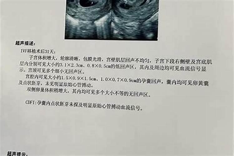 孩子胎停了用不用去做法事