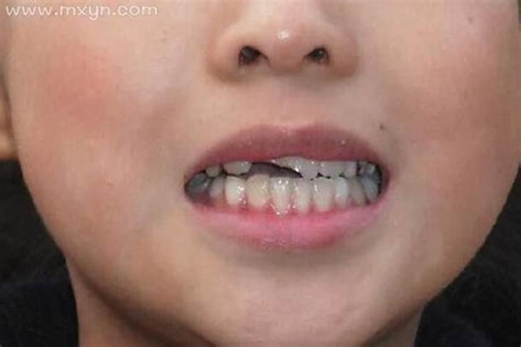 梦见自己门牙掉了是什么意思？