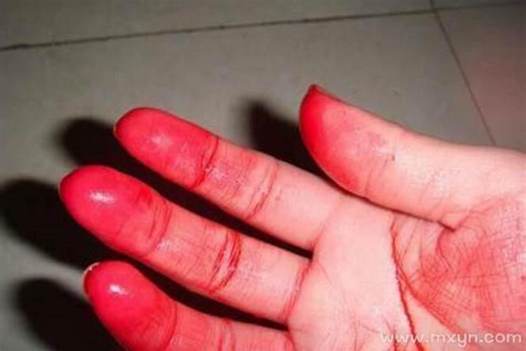 梦见手受伤流血解梦