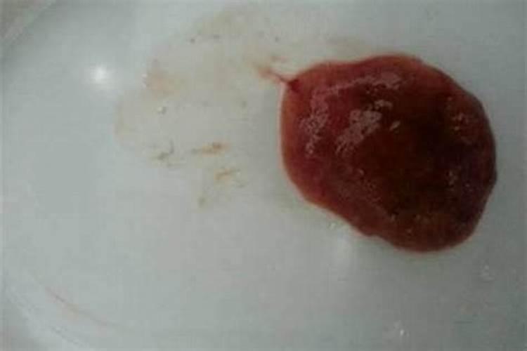 流产孕囊掉自家厕所里